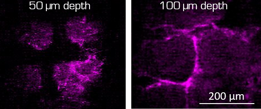 TI-PULS Biophotonics and medical applications